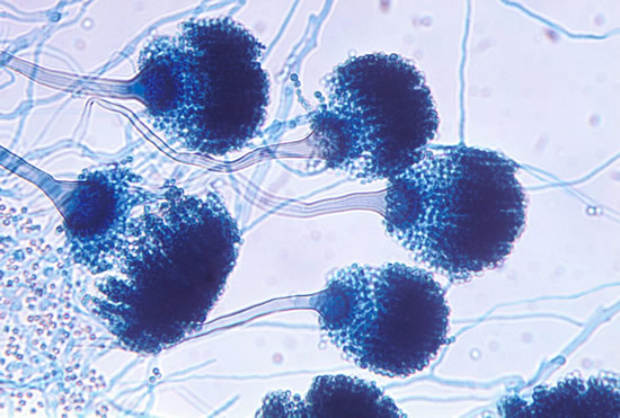 A Fumigatus Archives Page 5 Of 10 Aspergillus And Aspergillosis