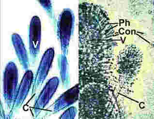 AclavcP2