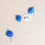 Ascospore_dic