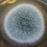 Asp[1]fumigatus