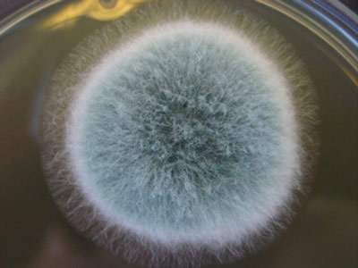Asp[1]fumigatus