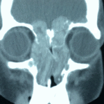 Ct02
