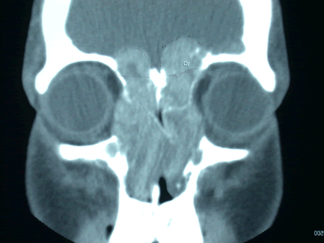Ct02