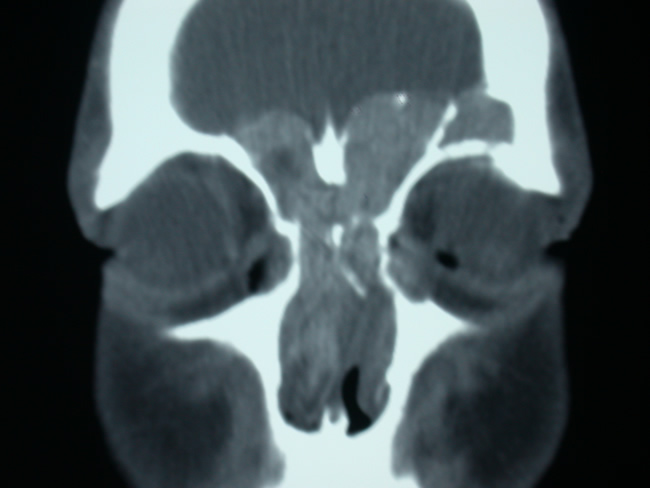 Ct03