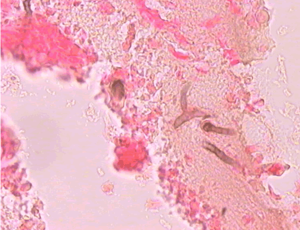 Histo01