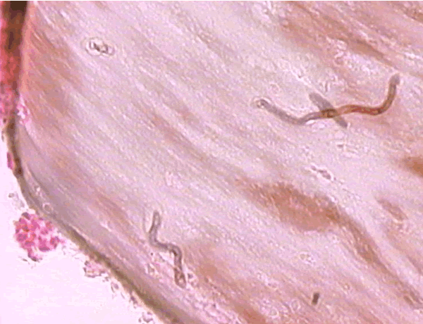Histo02