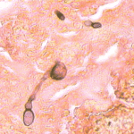 Histo03