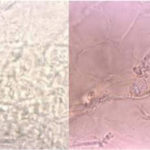 KOHnailprepmicrosc