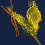 Neutrophilandbacteria