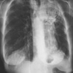 Image B. July 2001