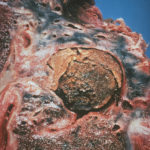 TBaspergilloma3