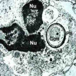 alvpolyc