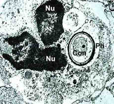 alvpolyc