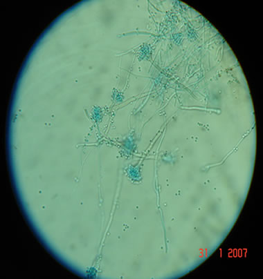 aspnigerfoot3