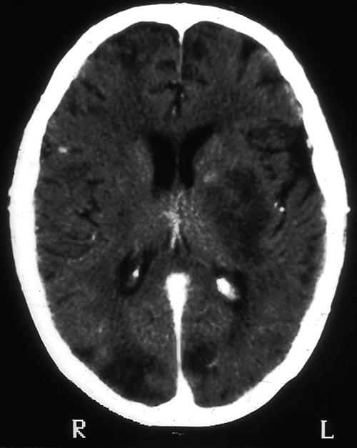 brain2