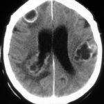 brain7