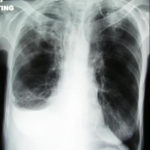 case2xray3