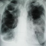case2xray6