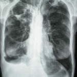 case2xray8