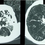 ctscan2