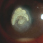 eye12AT