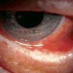 eye3ATullo