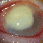 eye4ATullo