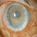 eye7ATullo