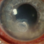 eye9AT