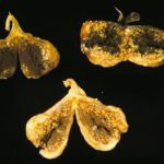 fig1
