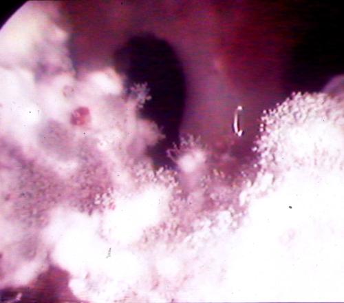 figure-1