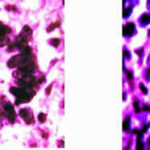 giantcells