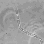 hypha