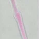 hypha