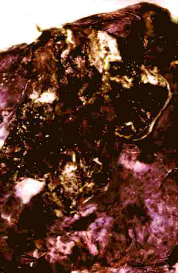 laglun1P