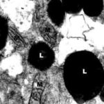 lysosomc