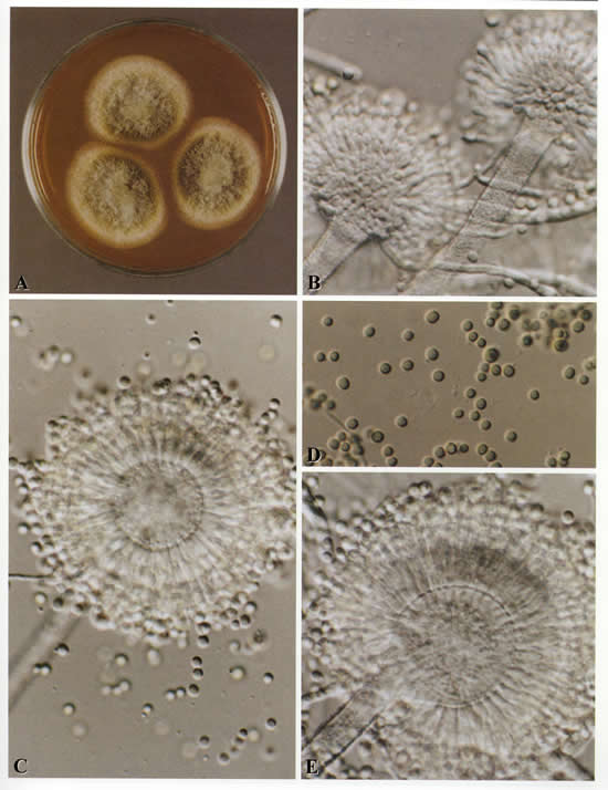 microflavus