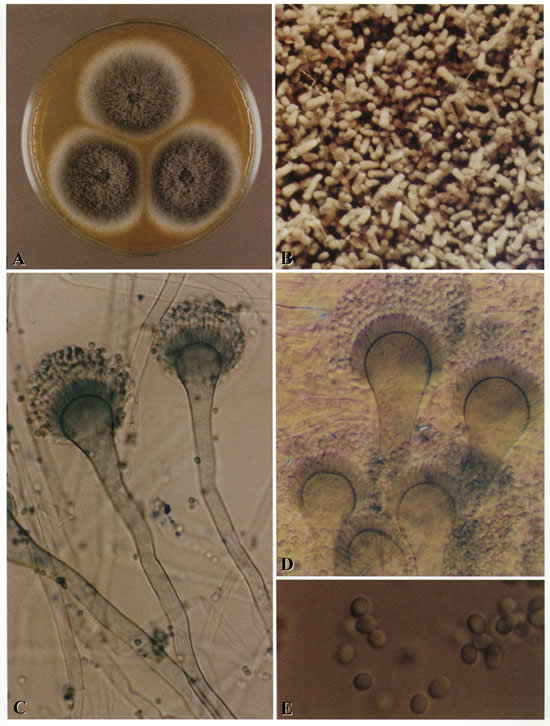 Aspergillus Fumigatus Fresenius Aspergillus And Aspergillosis