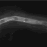 microtubules2