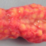pengadrenal2