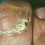 persiinail
