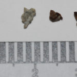 Pneumoliths