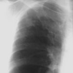 Image A. 10/95