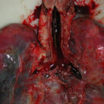 Fig1 Trachea and bronchi 