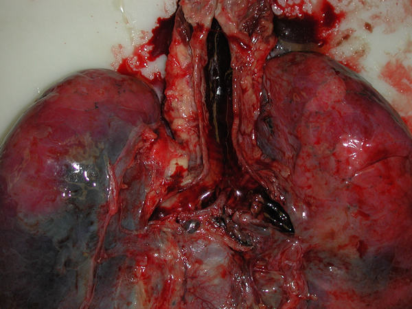 Fig1 Trachea and bronchi