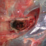 Fig2 Left main bronchus 