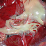 Fig3 Pulmonary artery 