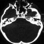 sinus6
