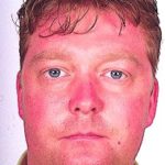 Facial erythema related to voriconazole