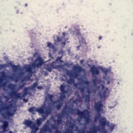 vet5